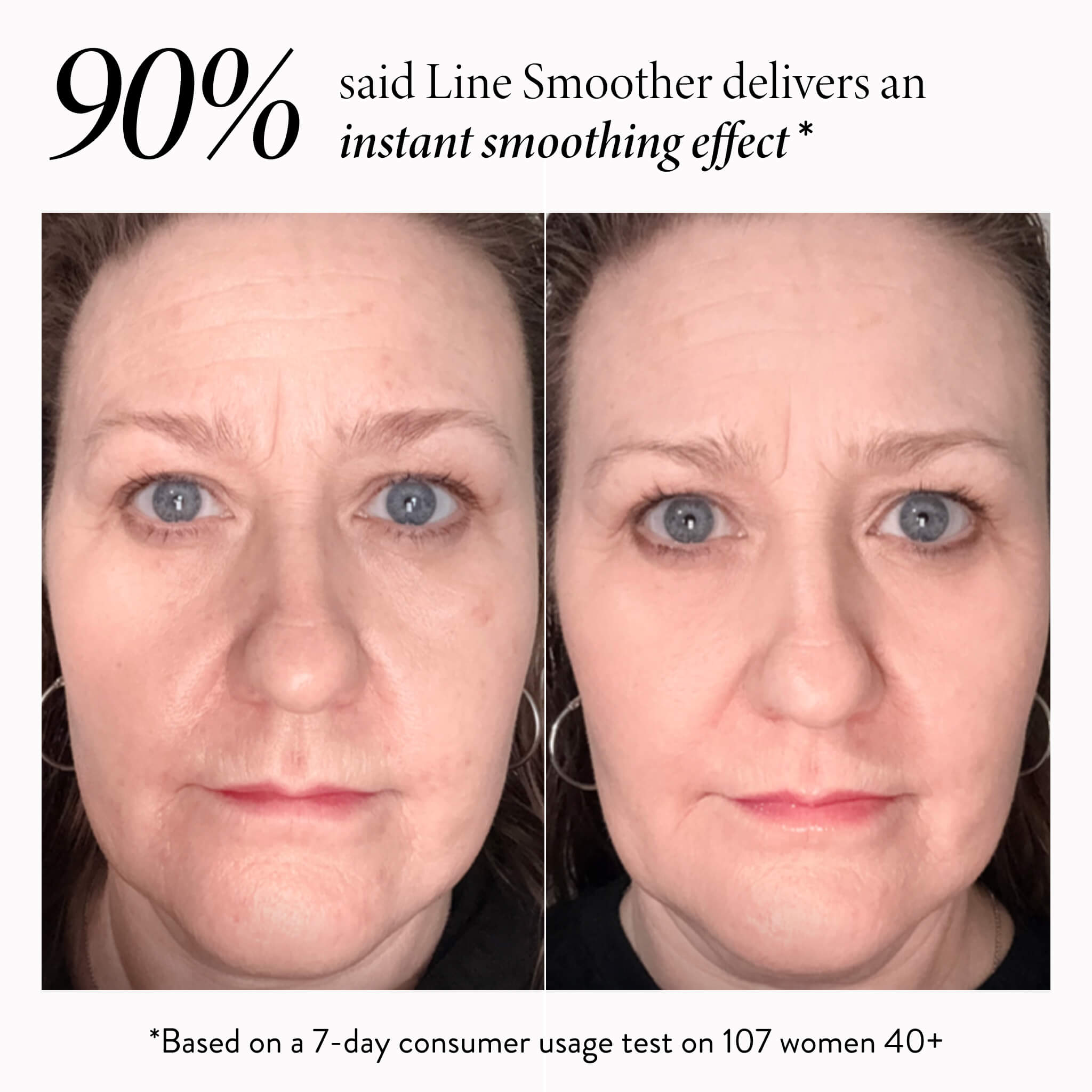Line Smoother Full Face Kit (3PC)